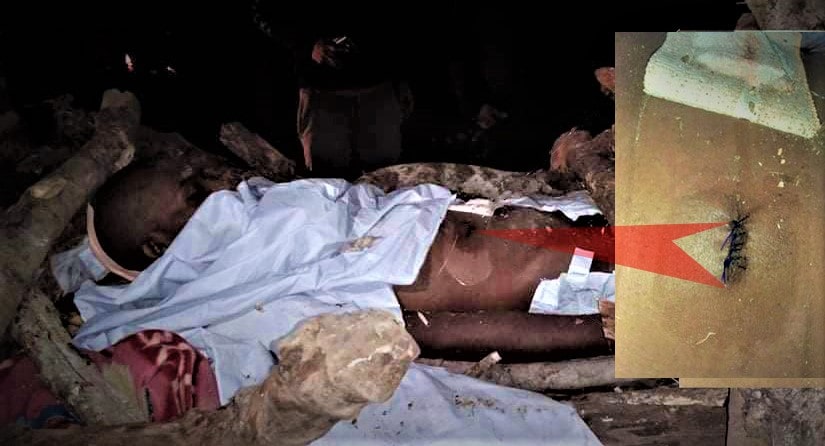 चिताबाट शव उठाएर आफन्तले पोष्टमार्टम गर्न लगेपछि image