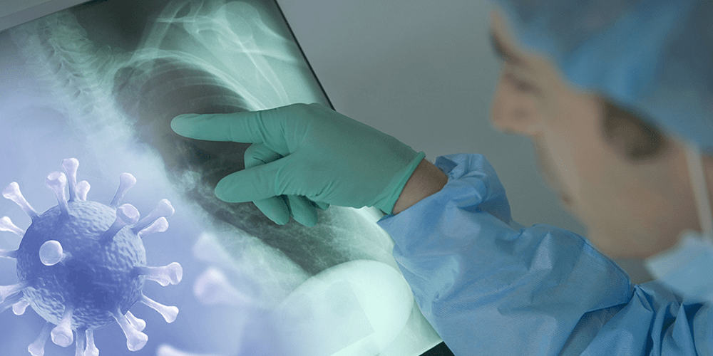 एकैदिन २४२८ जनामा कोरोना संक्रमण