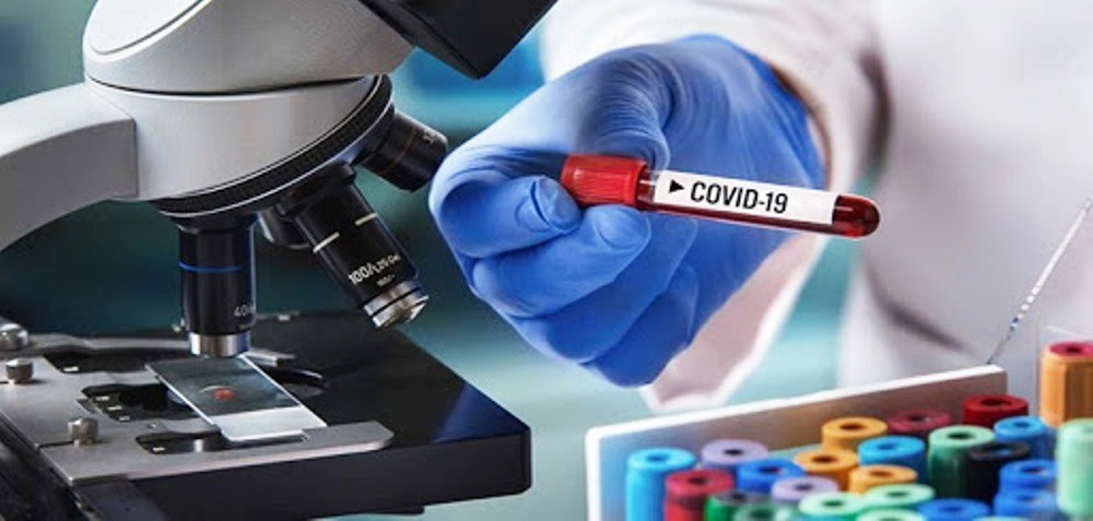 २४ घण्टामा २ लाख ८१ हजार संक्रमित, घट्दैछ भारतमा संक्रमण image