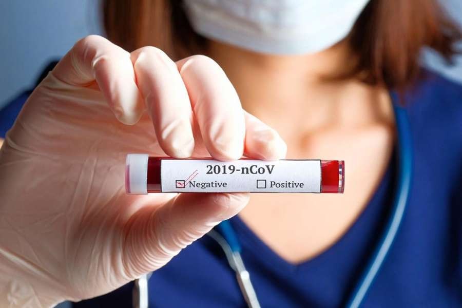 नमूना नै नलिई बन्छ पिसिआरको नेगेटिभ रिपोर्ट