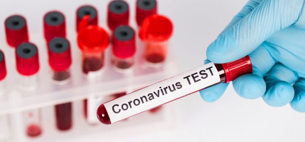 कोरोना परीक्षण मा रोक