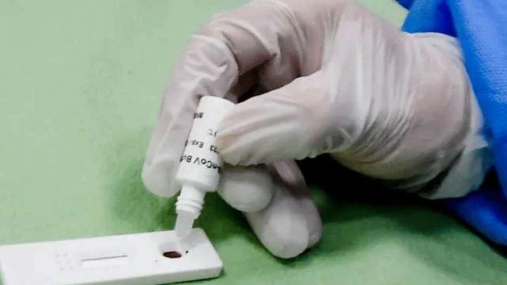 महानगरमा वृहत एन्टिजेन विधिबाट एकै दिन ९ सय ५७ जनाले कोभिड परीक्षण