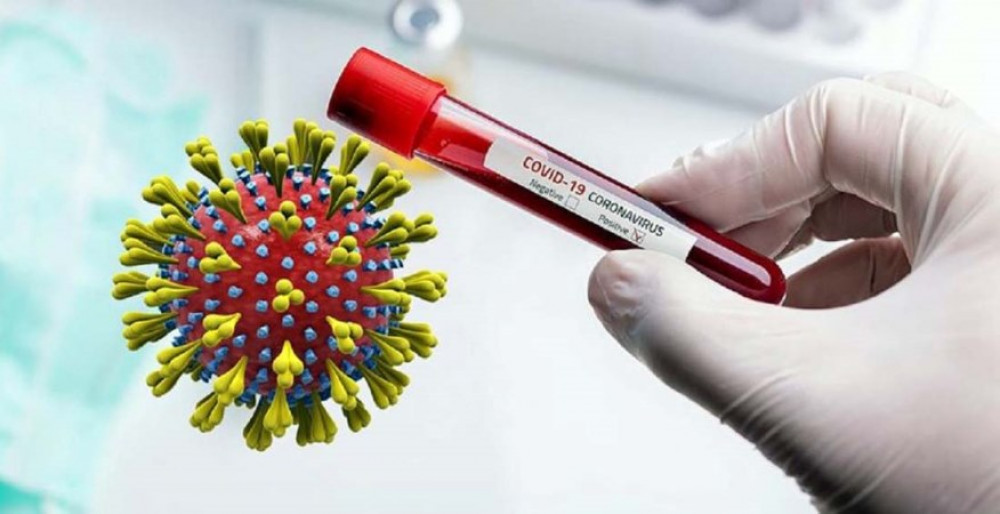 कर्णालीमा एकैदिन ११५ जनामा कोरोना सङ्क्रमण पुष्टि