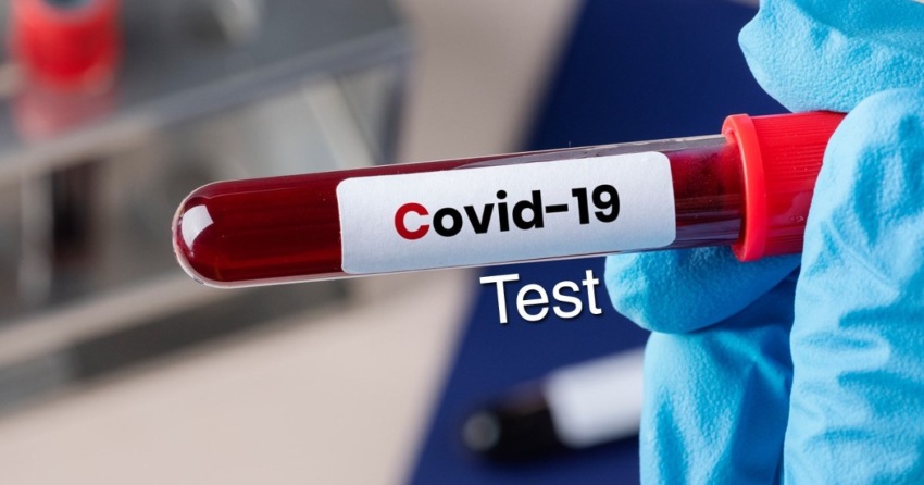 गत २४ घण्टामा देशभर ४ हजार १०७ जनामा कोरोना संक्रमण पुष्टि image