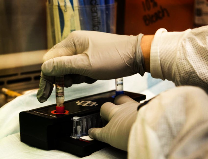 पीसीआर प्रयोगशाला सञ्चालनपछि तीन जिल्लाबासी लाभान्वित हुँदै