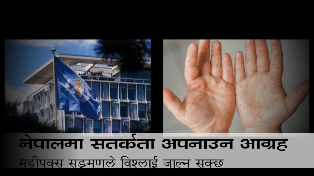 मङ्कीपक्स सङ्क्रमणले विश्लाई जाल्न सक्छ, नेपालमा सतर्कता अपनाउन आग्रह image