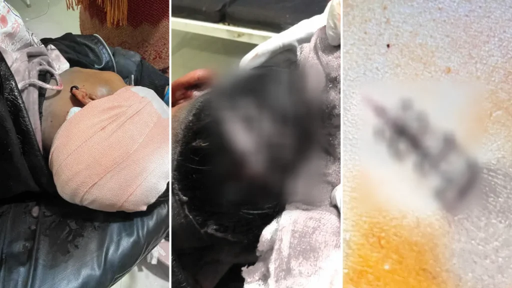 विवाहबाट फर्कँदै गरेका युवकमाथि सामूहिक आक्रमण, धारिलाे हतियार प्रहारपछि गम्भीर घाइते